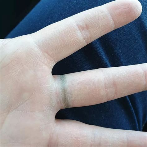 rings turn finger green
